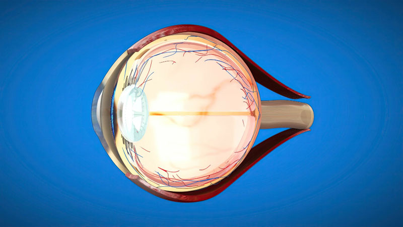 Best Keratoconus Treatment in Mumbai: A Complete Guide to C3R, Intacs & Corneal Transplants