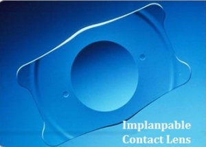 ICL Vs Contact lenses